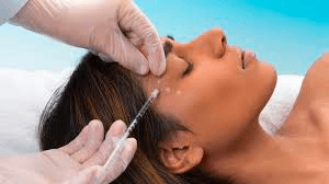 botox-image